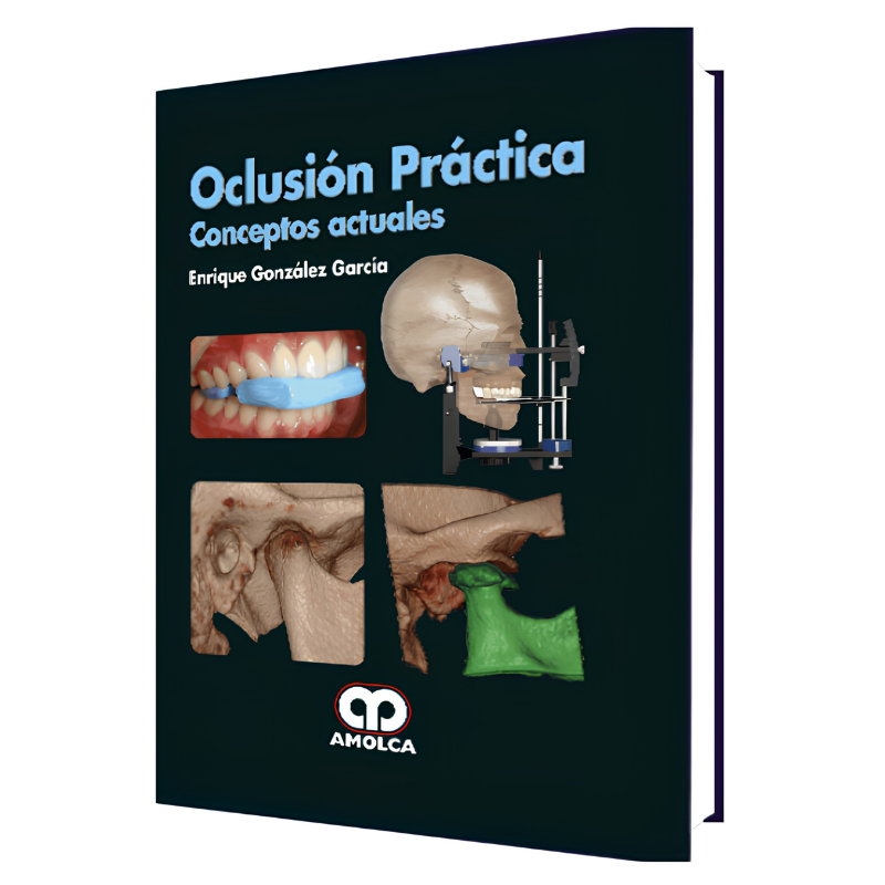 Oclusión Práctica - Conceptos Actuales. 2 Edición