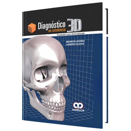 Diagnóstico 3D en Ortodoncia