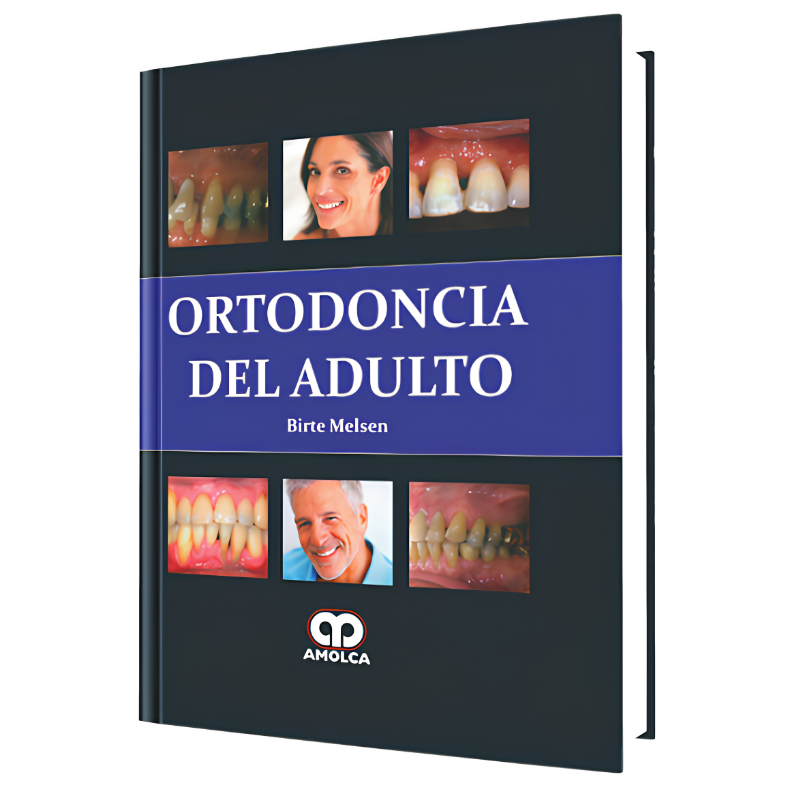 Adult orthodontics