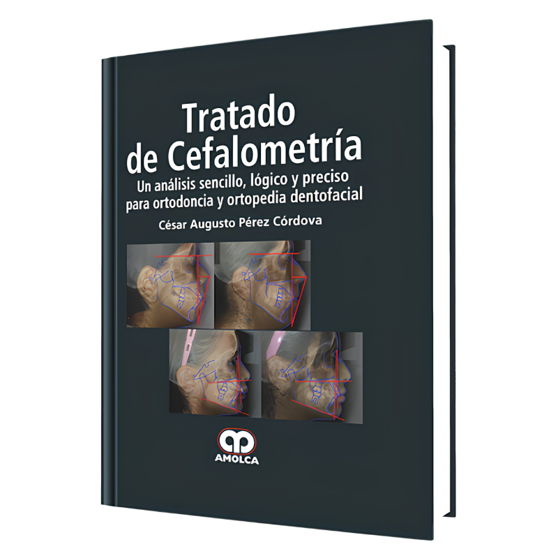 Cephalometry treaty