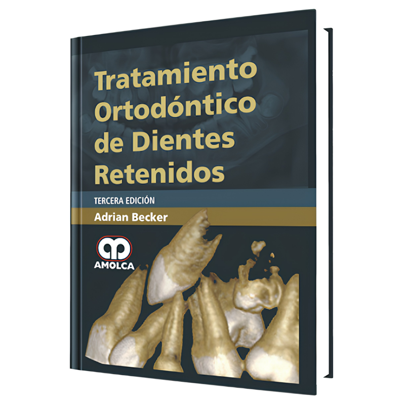 Orthodontic treatment of retained teeth. 3 edition