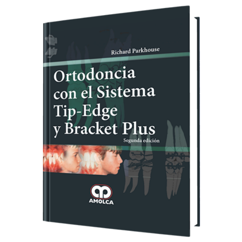 Orthodontics with the TIP-EDGE and BRACKET PLUS system. 2 edition