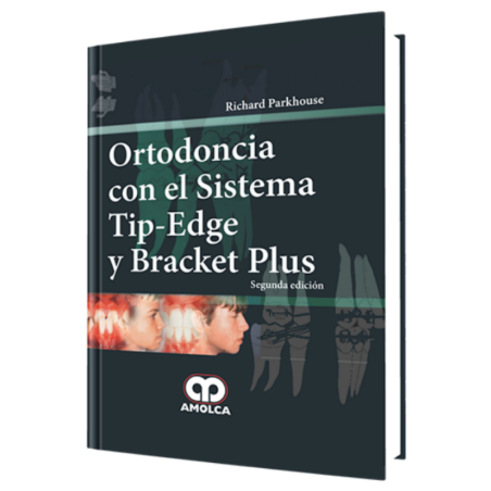 Ortodoncia con el Sistema Tip-Edge y Bracket Plus. 2 Edición
