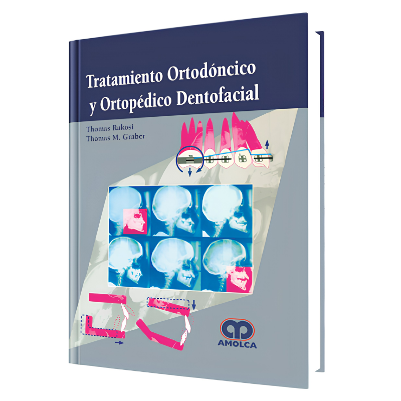 Tratamiento Ortodóncico y Ortopédico Dentofacial