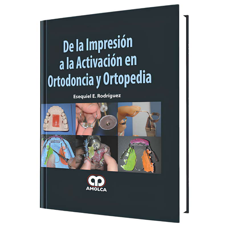 De la Impresión a la Activación en Ortodoncia y Ortopedia