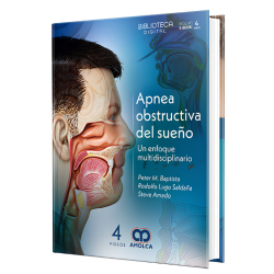 Apnea obstructiva del sueño. Un enfoque multidisciplinario