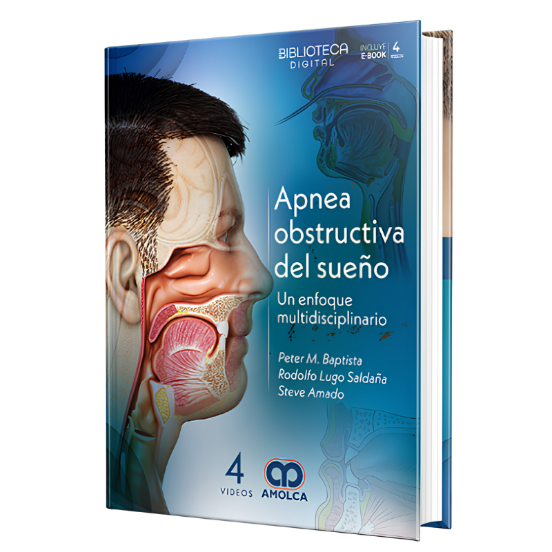 Apnea obstructiva del sueño. Un enfoque multidisciplinario