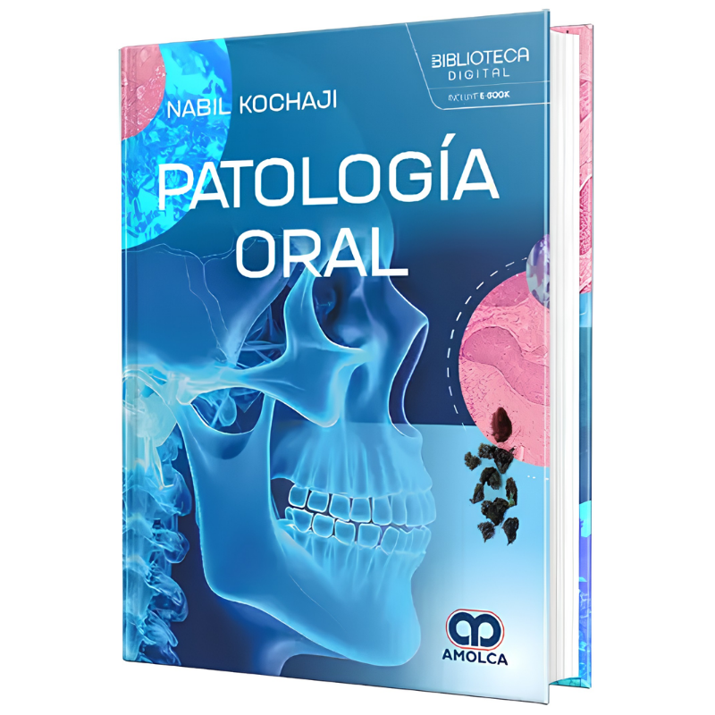 Patología oral