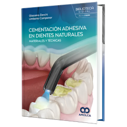 Cementación adhesiva en dientes naturales. Materiales y técnicas