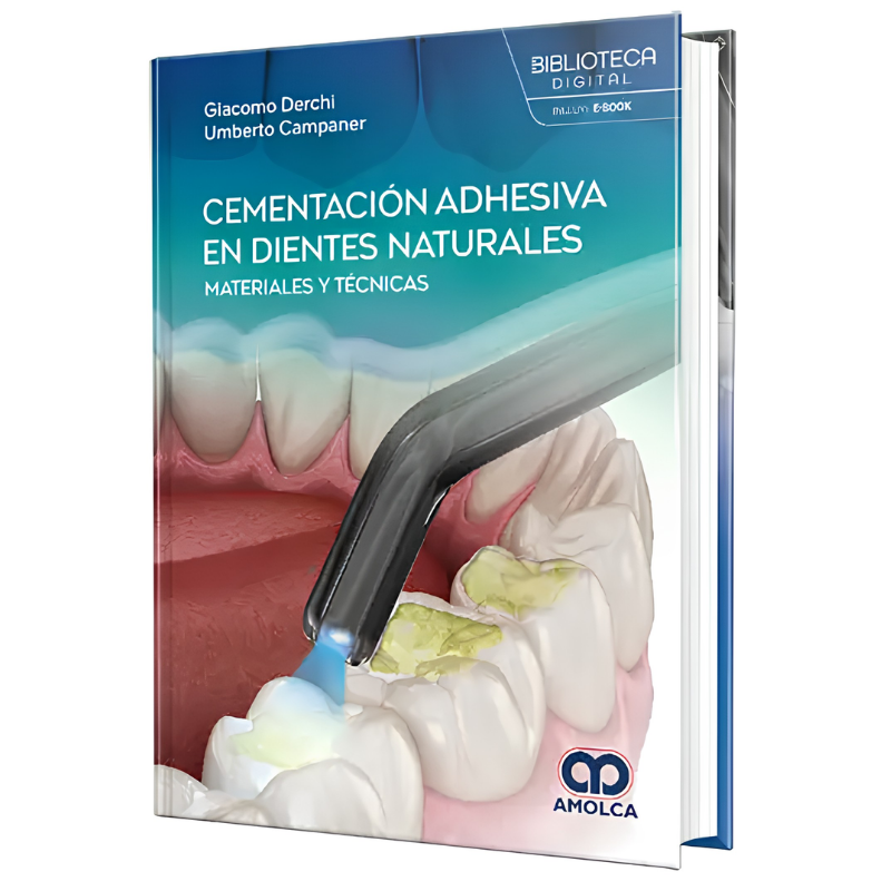 Cementación adhesiva en dientes naturales. Materiales y técnicas