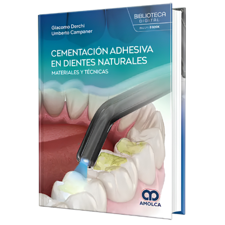 Cementación adhesiva en dientes naturales. Materiales y técnicas