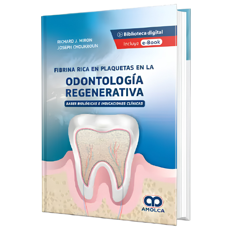 Fibrina Rica en Plaquetas en la Odontología Regenerativa