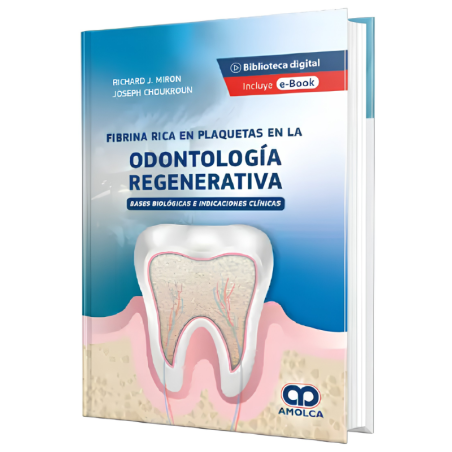 Fibrina Rica en Plaquetas en la Odontología Regenerativa