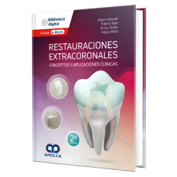 Restauraciones Extracoronales. Conceptos y Aplicaciones Clínicas