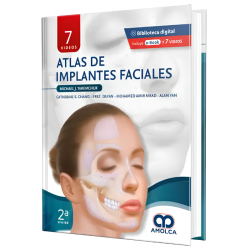 Atlas de implantes faciales