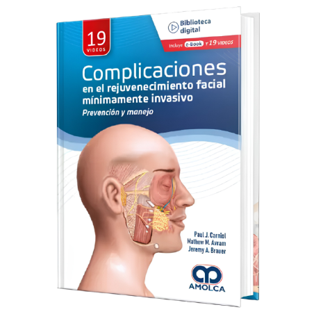 Complicaciones en el rejuvenecimiento facial mínimamente invasivo - Prevención y manejo