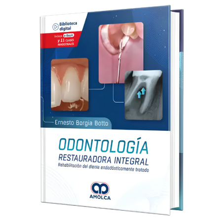 Odontología restauradora integral. Rehabilitación del diente endodónticamente tratado