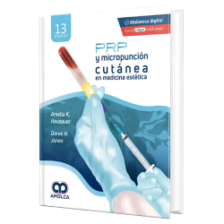 PRP Y Micropunción Cutánea en Medicina Estética