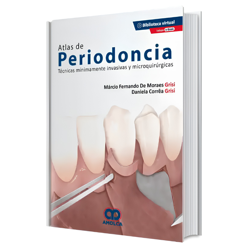 Atlas de Periodoncia