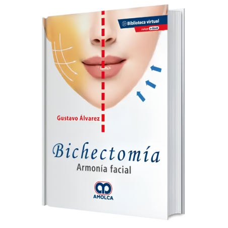 Bichectomía. Armonía Facial