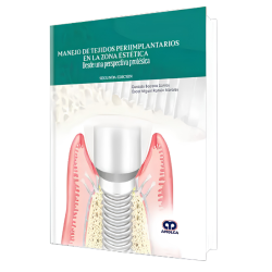 Management of periimplant tissues in the aesthetic area. From a prosthetic perspective. 2 edition