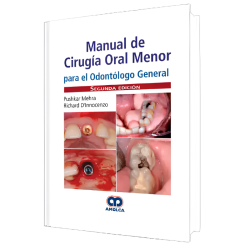 Manual de Cirugía Oral Menor para el Odontólogo General. 2 Edición