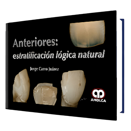 Anteriores: Estratificación Lógica Natural