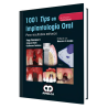 1001 Tips en Implantología Oral