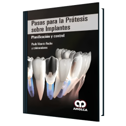 Pasos para la Prótesis Sobre Implantes