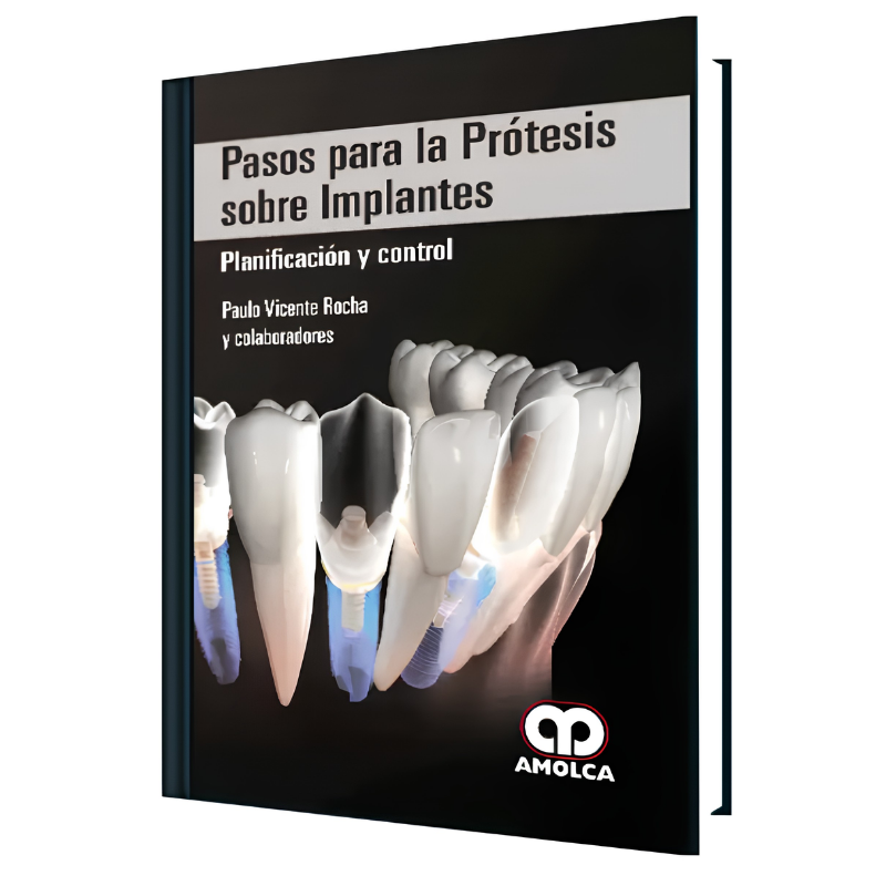 Pasos para la Prótesis Sobre Implantes