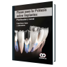 Pasos para la Prótesis Sobre Implantes