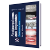Restauraciones con Implantes. Guía Paso a Paso. 3 Edición