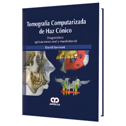 Tomografía Computarizada de Haz Cónico
