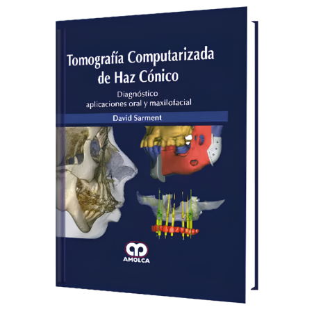 Conical beam computed tomography
