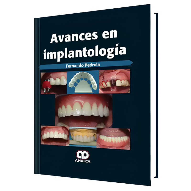 Avances en Implantología