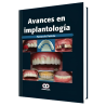 Avances en Implantología