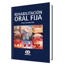 Rehabilitación Oral Fija