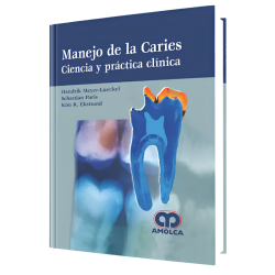 Manejo de la Caries Ciencia y práctica clínica