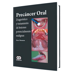 Precáncer oral. Diagnosis and treatment of potentially malignant lesions
