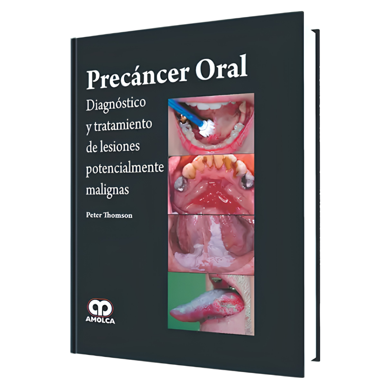 Precáncer Oral. Diagnóstico y Tratamiento de Lesiones Potencialmente Malignas