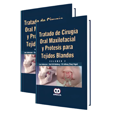 Tratado de Cirugía Oral Maxilofacial y Prótesis para Tejidos Blandos