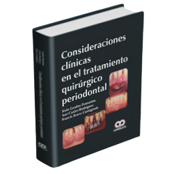 Consideraciones Clínicas en el Tratamiento Quirúrgico Periodontal