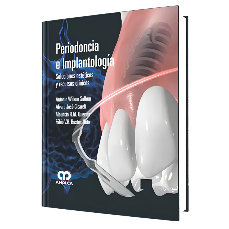 Periodoncia e Implantología