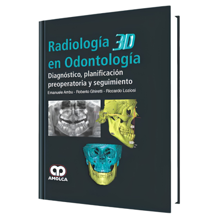 Radiología 3D en Odontología