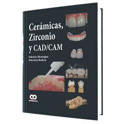 Cerámicas, Zirconio y CAD/CAM