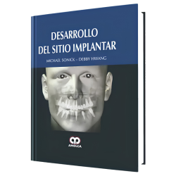Desarrollo del Sitio Implantar
