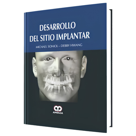 Desarrollo del Sitio Implantar