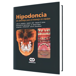 Hipodoncia
