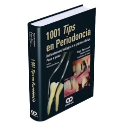 1001 Tips en Periodoncia