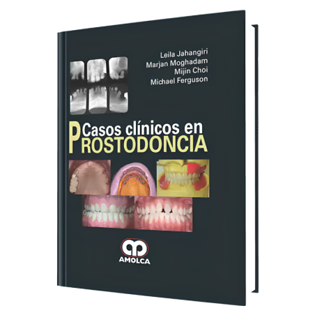 Casos Clínicos en Prostodoncia